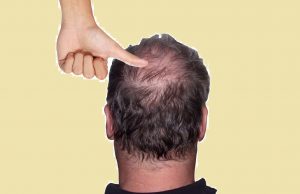 8 signalen waaruit blijkt dat jij compleet onder de duim zit bij je vriendin! Onder de duim