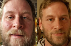 Voor- én na foto’s van 16 mensen die compleet zijn gestopt met drinken! Drinken