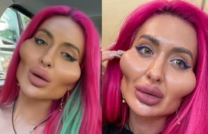 Vrouw met de grootste jukbeenderen ter wereld laat zien hoe ze er voorheen uit zag! Jukbeenderen