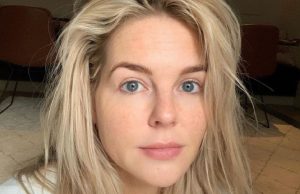 Zien: Op deze foto zijn de veel besproken fillers van Chantal Janzen duidelijk te zien! Chantal Janzen