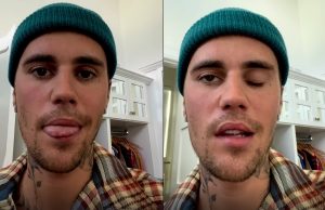 Bizar: Justin Bieber plaatst video om te laten zien wat er mis met zijn gezicht is! Justin Bieber