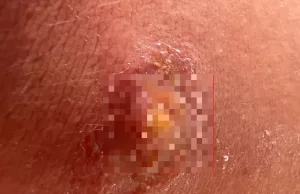 Freek Vonk deelt bizarre beelden van bevalling van Kwak Vonk! Freek Vonk