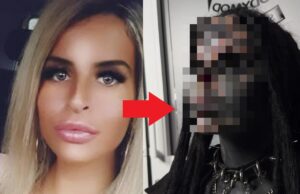 Daniëlle uit Breda is de eerste vrouw ooit die haar neus vrijwillig heeft laten verwijderen!