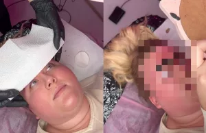 Deze dame is absoluut niet tevreden met haar nieuwe permanente wenkbrauwen! Wenkbrauwen