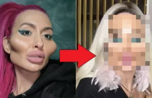 Oekraïnse Anastasia heeft na grootste jukbeenderen ook grootste onderkaak! Jukbeenderen