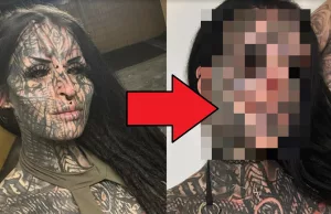 Daniëlle uit Breda heeft na neusamputatie ook tandvlees laten ‘rotten’! Breda