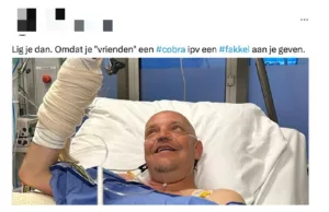 Foto: PSV-supporter die hand verloor door cobra: ‘Vriend zei dat het een fakkel was…’ PSV