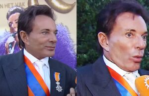 Geschrokken reacties door nieuw gezicht van Gerard Joling bij interview: ‘Er komt nóg een operatie aan!’