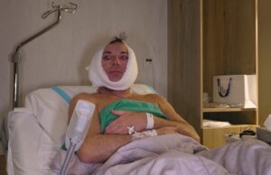 Gerard Joling is wéér onder het mes gegaan, dit keer nogal rigoureus: ‘Dit is toch véél te strak Gerard?’ Gerard Joling